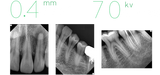 Genoray All in One Porable X-ray System Zen-PX4